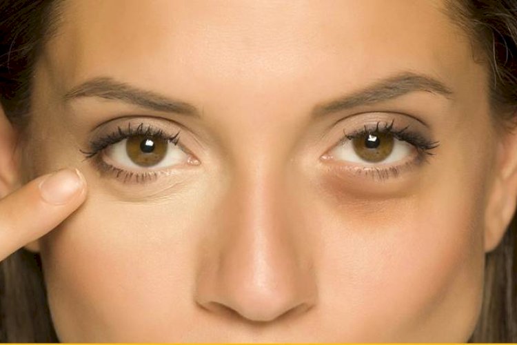 जानिए आंखों के नीचे सूजन का कारण और ठीक करने का उपाय