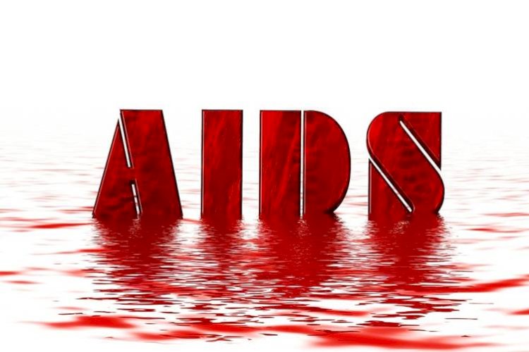 एड्स: लक्षण, कारण, निदान, इलाज और प्रबंधन