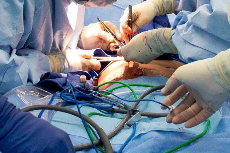 पित्त की थैली में पथरी का डॉक्टरों ने किया सफल ऑपरेशन