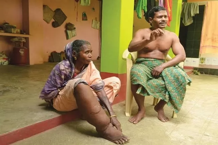 फाइलेरिया उन्मूलन की राह पर यूपी, अब साल में एक बार चलेगा एमडीए