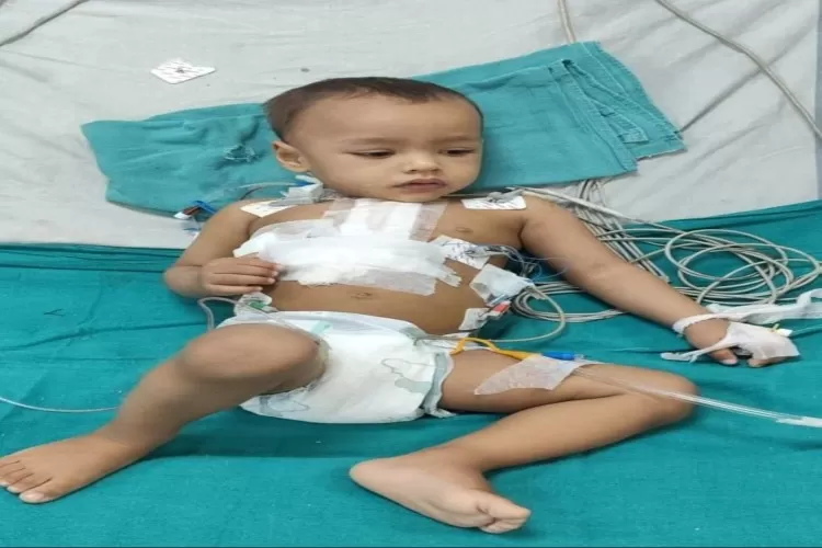 RBSK योजना से मासूम को मिली नई जिंदगी जन्मजात हृदय रोग की निःशुल्क सर्जरी  